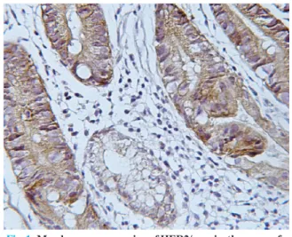 Table 1:  expression of heR-2/neu and abnormal expression of e–cadherin,   hMlh1 and hMSh2 in gastric dysplasia.