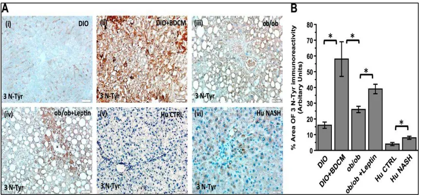 Figure 2.2 Leptin-induced NADPH oxidase activation causes peroxynitrite-mediated oxidative stress in NASH of both mice and humans
