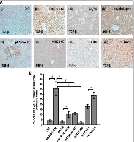 Figure 2.5 Leptin-induced NADPH oxidase activation and corresponding induction of miR21 regulate transforming growth factor (TGF)-β levels in mice and human NASH
