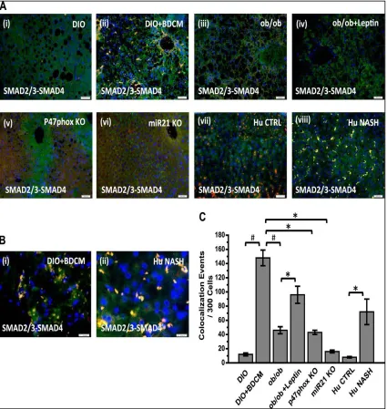 Figure 2.6 Leptin-mediated NADPH oxidase activation and corresponding induction of miR21 are crucial for regulation of SMAD2/3-SMAD4 assembly in the nucleus