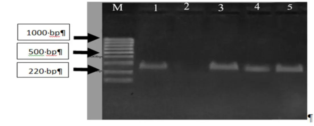 Figure 2. Gel electrophoresis of PCR products for presence of silE gene in E. coli isolates