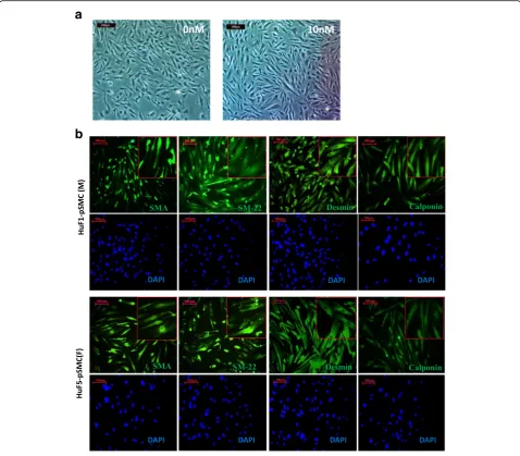 Fig. 2 Characterization of smooth muscle progenitor cells (than 95% of derived pSMCs expressed calponin and desmin, >90% SM-22, and >85% SMA when superimposed with DAPI.pSMCs) derived from male and female hPSCs