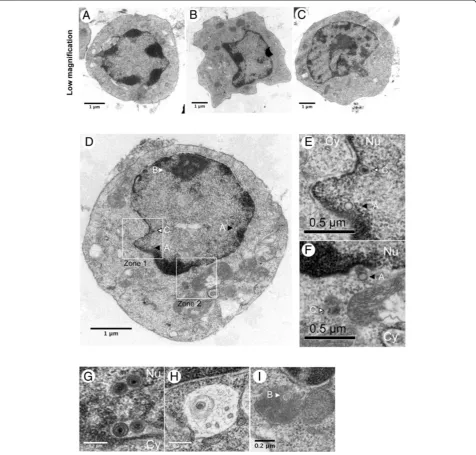 Figure 5 MDV particles in rRB-1B EGFP22 induced tumor cells examined by TEM.dense material and a membrane
