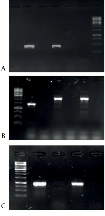 Figure 1. A) PCR amplification of eae gene. Lanes 1-4: presumptive EPEC  isolated from patients, lane 5: Positive control, Lane 6: negative control