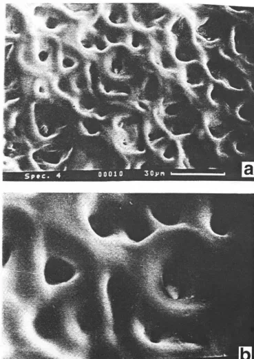 Figure 2.3: sodium hydroxide (a) and (b). SEM's of whey protein concentrate deposit contacted with 0.1 wt% at 50°C for 2 minutes