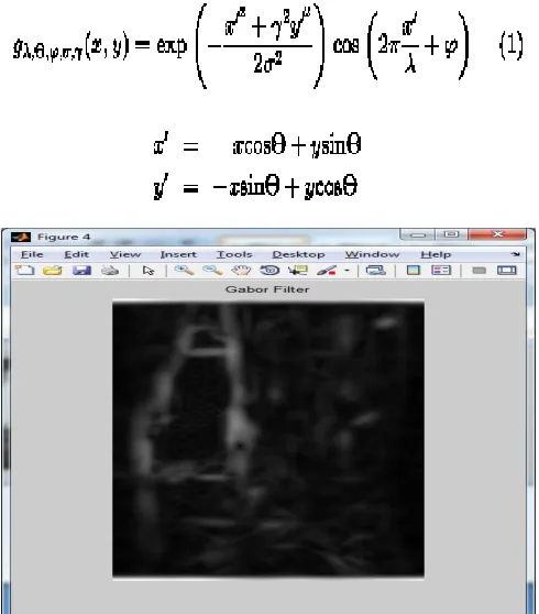 Fig 2. MRI input image 