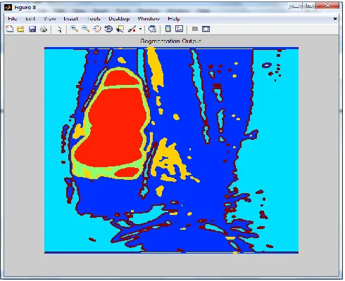 Fig 5. Segmented image 