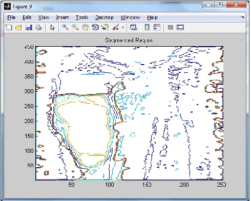 Fig 7. Extracted region 