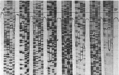 Figure 4.1-4 The impulse noise smoothed image. 
