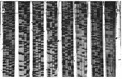 Figure 4.2-7 Contrast enhanced image with profile. 