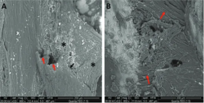 Fig. 6. Scanning electron microscopic photomicrograph of group 3  showing eroded disorganized bone architecture (asterisks), mesh work  of mineralized collagen fi bers (red arrows) and a crack along the bone  surface (white arrow) (SEM ×600)