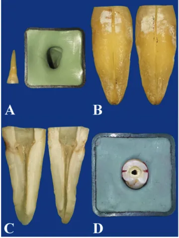Fig. 1. A – a set matrix of putty impression material for tooth reassembling; 