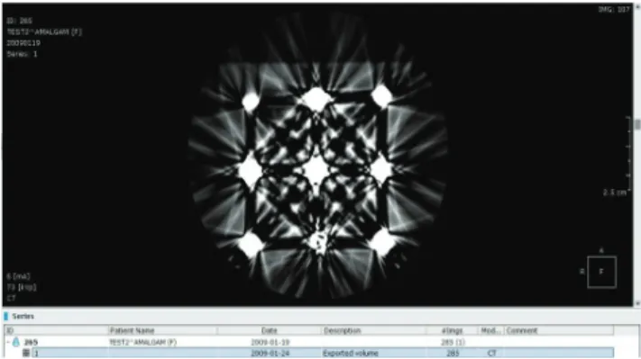 Fig. 5. The cone-beam computed tomography (CBCT) image of amalgam  cubes scanned by a Kodak CBCT system