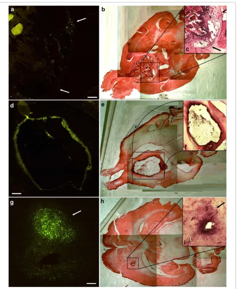 Figure 2 Frozen sections (horizontal) of the BoHV-4 injected rat brain gliomas. EGFP expression in the peripheral area of tumour 48 hourspost BoHV-4 injection (a, bar = 500 μm), hematoxylin eosin of the whole section (b) with magnification of the tumour ar