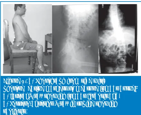 Figure 1. a) Photograph from side with 