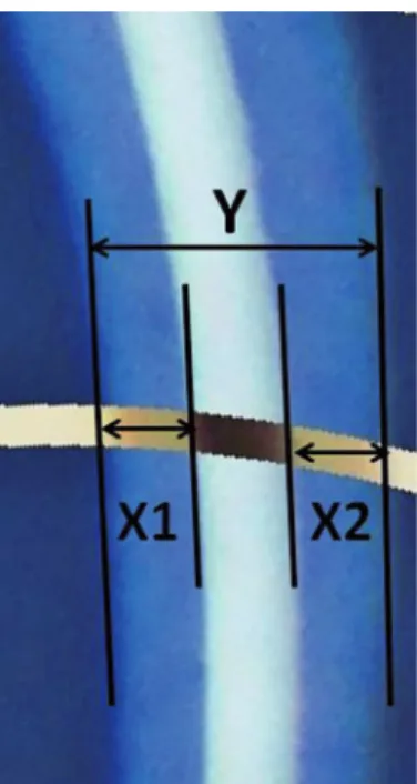 Fig. 3. Comparison of the centering  ratio