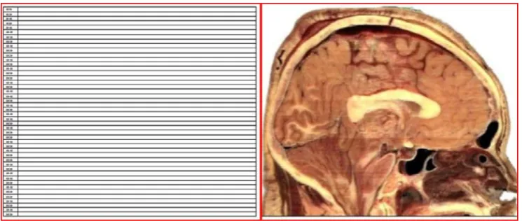 Figure 1 (Left): Horizontal lines at 10-mm intervals were drawn to scale on an MS™ Word document in Web layout view and this page was scanned as a JPEG image without resizing