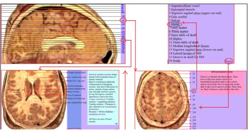 Figure 10: Composite figure showing interactive hyperlinks and interconnectivity between various assessment 'child' image will take one to the correct answer