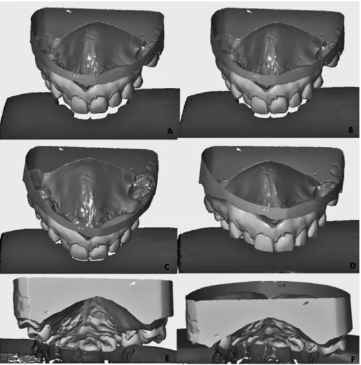 Fig. 3. A 3D compari- compari-son of features of the  maxillary teeth of an  individual participating  in the experiment and  bitemarks (“bite-  -off”) on cheese using  GOM Inspect V7 SR2  software
