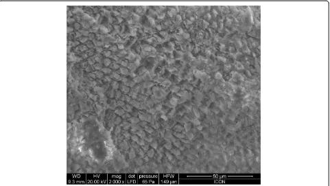 Figure 4 SEM observation of acid-etched enamel without any pre-treatment.
