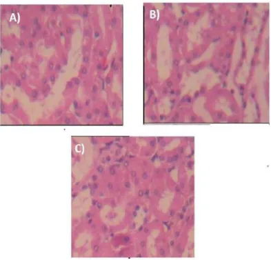 Figure 4. Shows histological structure of kidney treated with (A) aqueous extract (B) ethanol extract (C) acetone extract of A