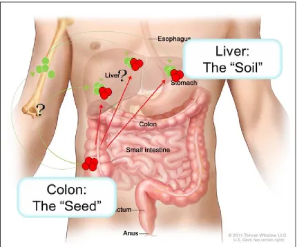 Figure 1.3: Model of pre-metastatic niche formation. The primary tumor in the colon is represented as the “seed” which send out signals systemically