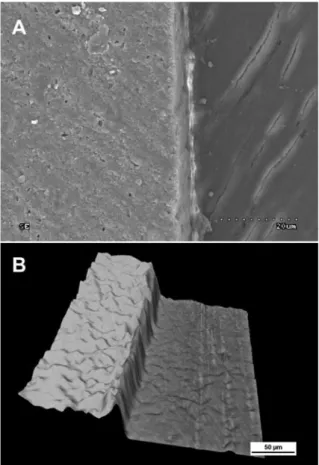 Fig. 3. Figure ‘A’ shows the sEM image of the cross- cross-section of the specimen without previous etching of  dentine