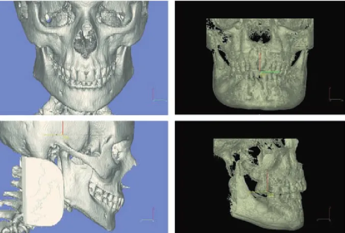 Fig. 6. Comparison between field of view of MSCT (blue  background) and CBCT scanning devices (black  back-ground)