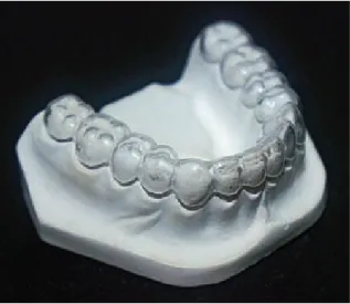 Fig. 1. Schwarz retainer