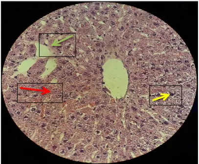 Figure 6: Photomicrograph of rat liver tissue in experimental group 2. In this group, necrosis was  Fig