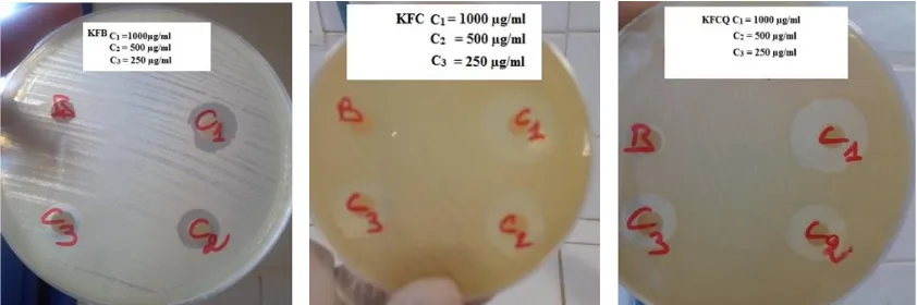 Figure 2:  Effect of KFB, KFC and KFCQ copolymers on the growth of Escherichia coli (ATCC 25922).