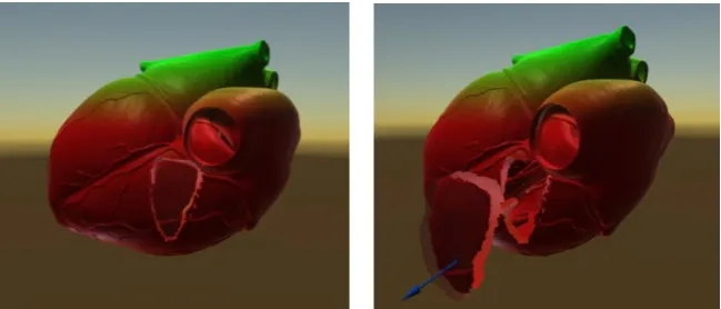 Figure 1 – sectional view of the heart in real time in the system HoloSurgeri 