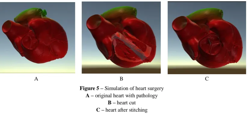 Figure 4 – Preparation of 3D model in the program software DoctorCT-Slicer A – marker of the tumor secretion 