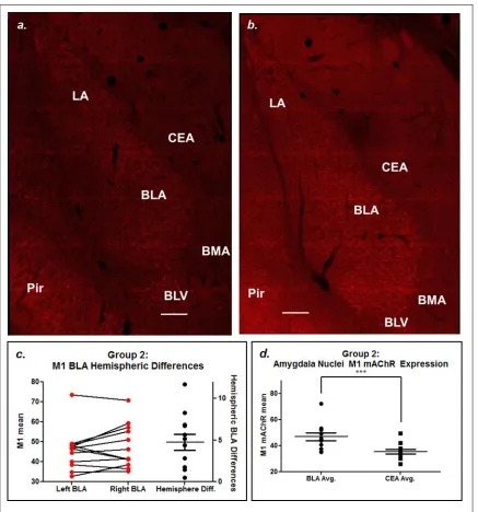 Figure 3.3: M1 mAChR Immunofluorescence. Image a has low BLA M1 mAChR expression. Image b has high BLA M1 mAChR expression