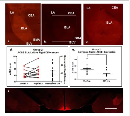 Figure 3.5: Acetylcholinesterase Immunofluorescence. Image a. AChE labeled section considered high expressing