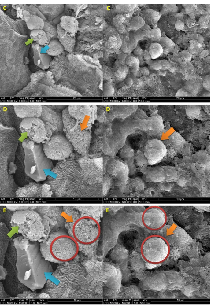 Fig. 4. Comparison of abnormal specimen images for osmium HMDS (left)  versus no osmium HMDS (right)  techniques 