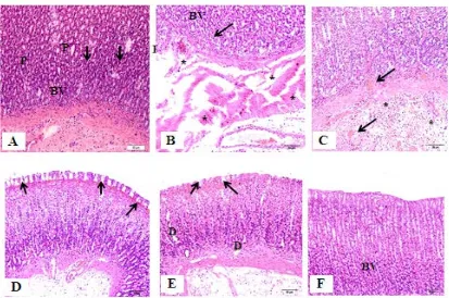Figure 4:  Effect of OLE on the stomach tissue histopathological changes detected by H & E staining in IND-induced peptic ulcer in rats