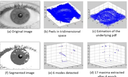 Figure 6 presents the procedure for classifying the iris image. 