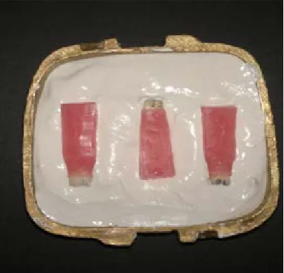 Fig. 1. Preparation of wax cone with 45º angle 