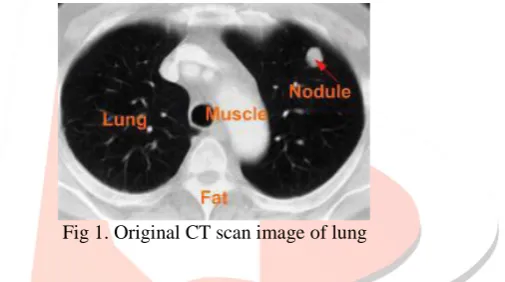 Fig 2: Segmentation: a) Original Image, b) Background removed Image, c)Threshold Image
