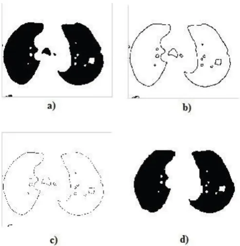 Figure 3 shows the post-processing enhancement process in detail. a)Morphological Operations,   b)Border Detected Image, c)Border Thinned Image, d)Filled Image 