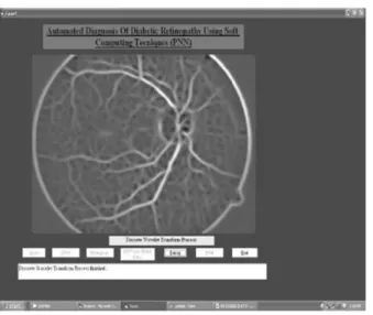 Figure 7. Eye Image after Matched Filters 