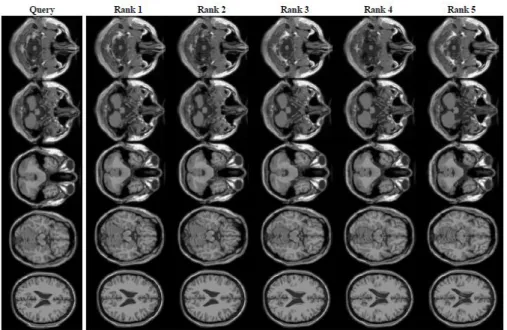 Figure 4. Query Image and 5 Relevant Images 
