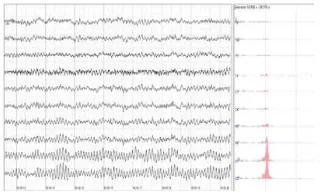 Figure d.1. 400px-Human EEG without alpha     rhythm These results are presented not to suggest that they 