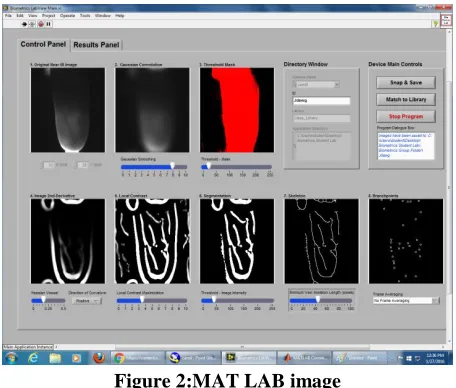 Figure 2:MAT LAB image  