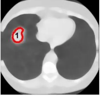 Fig. 1 Log-gabor enhanced image 