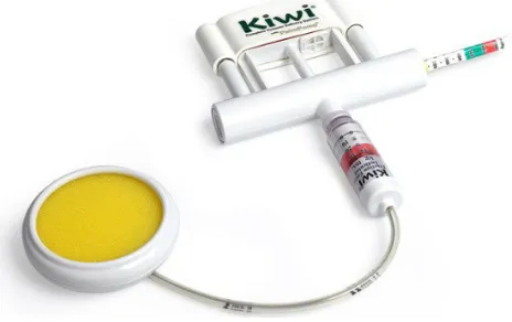 Figure 1 Kiwi® OmniCup® Complete vacuum Delivery System with PalmPump™.