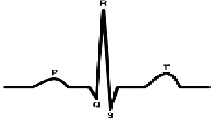 Fig. 1:  An ECG waveform 