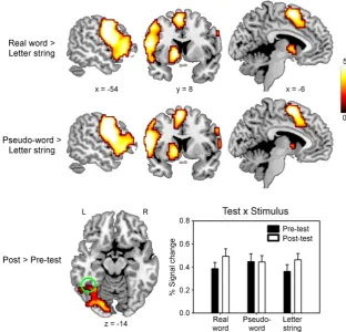 Figure 3: Brain activity modulated by SESSION (post > pre-test) and/or STIMU-LUS TYPE (real word > letter string, or pseudo-word > letter string)