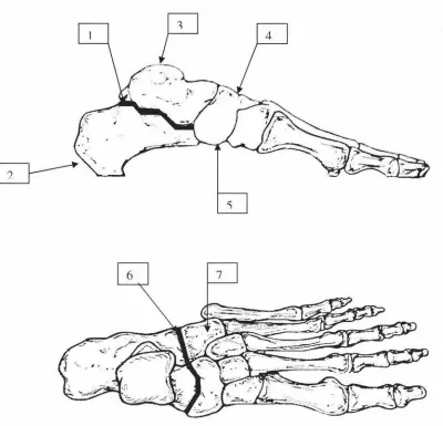 Figure l Selected Joints and Bones of the Foot 